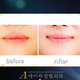 Illustration for article titled South Korean Plastic Surgeons Say Smile Surgery Is Totally Necessary